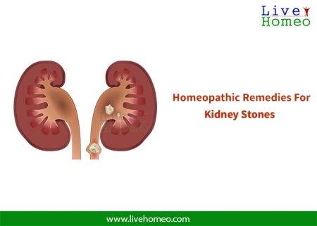  Get Kidney Stones Cured With Homeopathy in Coimbatore